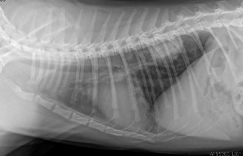 흉부 Lateral 방사선 영상