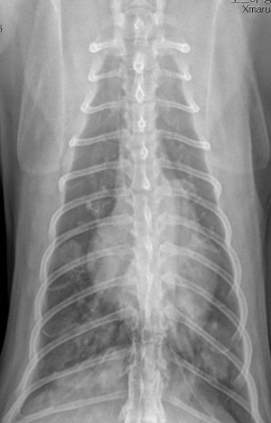 흉부 VD 방사선 영상
